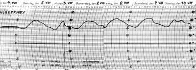 Temperaturstatistik August 1975